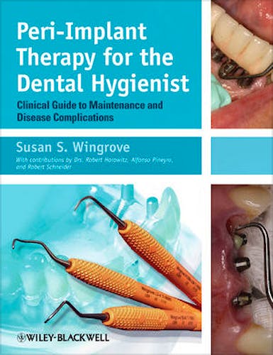 Portada del libro 9780470962855 Peri-Implant Therapy for the Dental Hygienist. Clinical Guide to Maintenance and Disease Complications