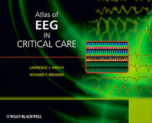 Portada del libro 9780470987865 Atlas of EEG in Critical Care