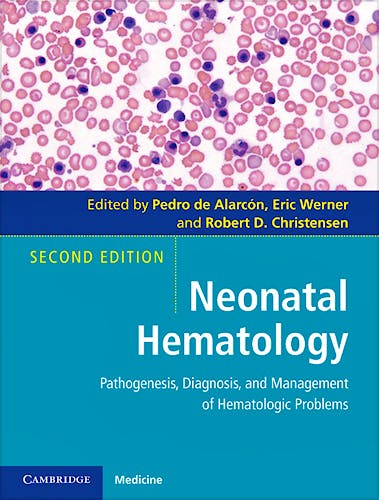 Portada del libro 9780521119313 Neonatal Hematology. Pathogenesis, Diagnosis, and Management of Hematologic Problems