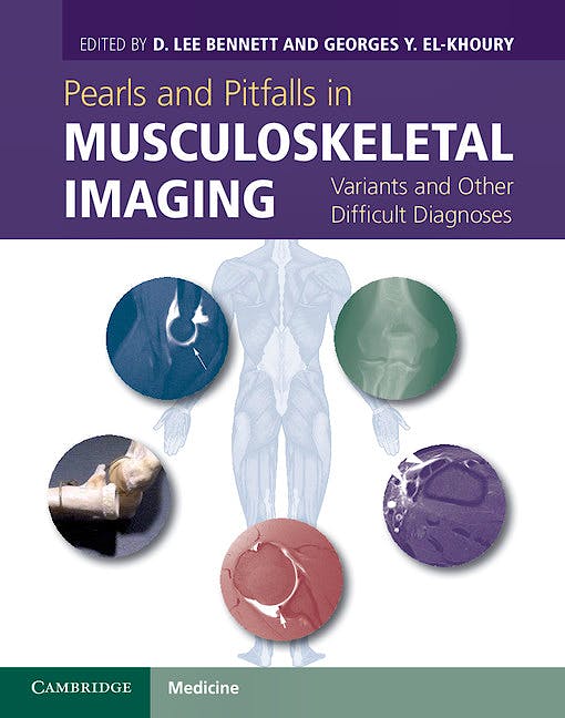 Portada del libro 9780521196321 Pearls and Pitfalls in Musculoskeletal Imaging. Variants and Other Difficult Diagnoses