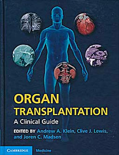 Portada del libro 9780521197533 Organ Transplantation. a Clinical Guide