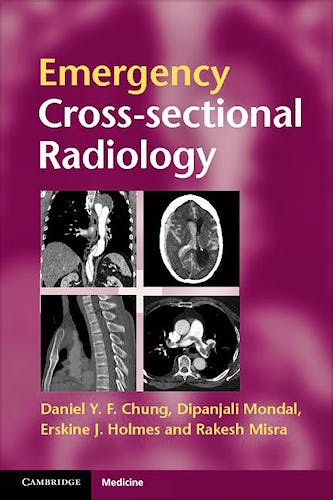 Portada del libro 9780521279536 Emergency Cross-Sectional Radiology