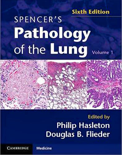 Portada del libro 9780521509954 Spencer's Pathology of the Lung, 2 Vols.