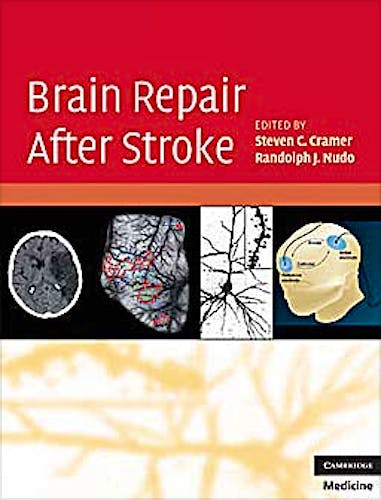 Portada del libro 9780521515337 Brain Repair after Stroke