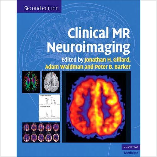 Portada del libro 9780521515634 Clinical MR Neuroimaging. Physiological and Functional Techniques
