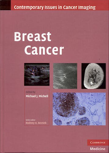Portada del libro 9780521519502 Breast Cancer (Contemporary Issues in Cancer Imaging)
