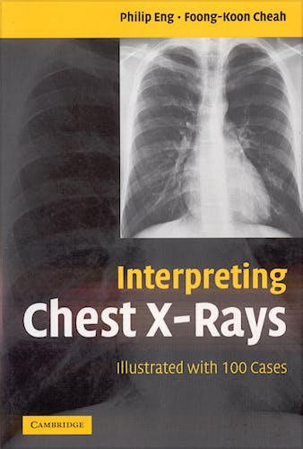 Portada del libro 9780521607322 Interpretating Chest X-Rays