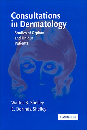 Portada del libro 9780521616584 Consultations in Dermatology. Studies of Orphan and Unique Patients