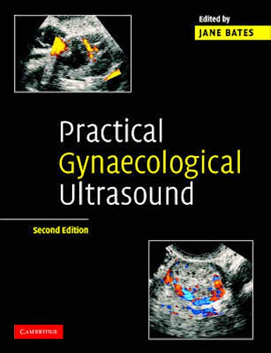 Portada del libro 9780521674508 Practical Gynaecological Ultrasound