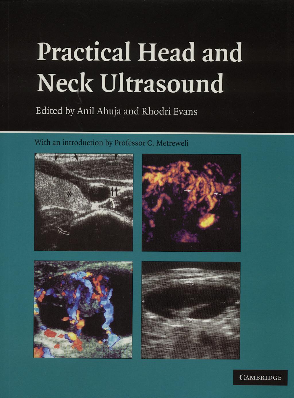 Portada del libro 9780521683210 Practical Head and Neck Ultrasound