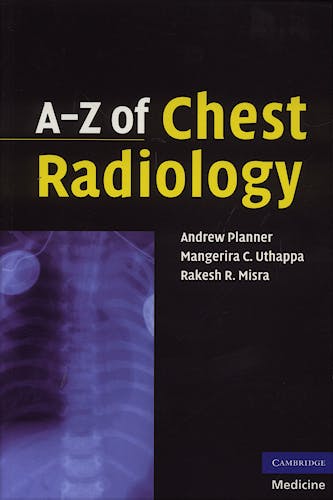 Portada del libro 9780521691482 A-Z of Chest Radiology