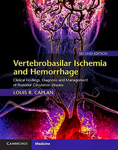 Portada del libro 9780521763066 Vertebrobasilar Ischemia and Hemorrhage. Clinical Findings, Diagnosis and Management of Posterior Circulation Disease