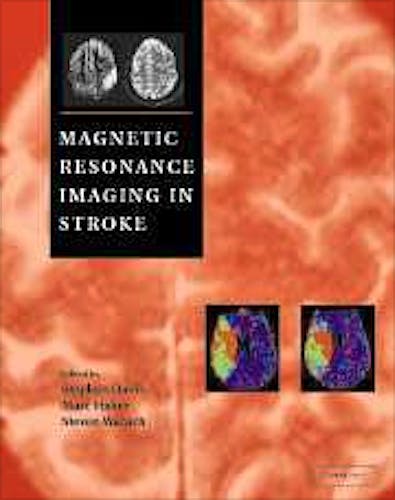 Portada del libro 9780521806831 Magnetic Resonance Imaging in Stroke