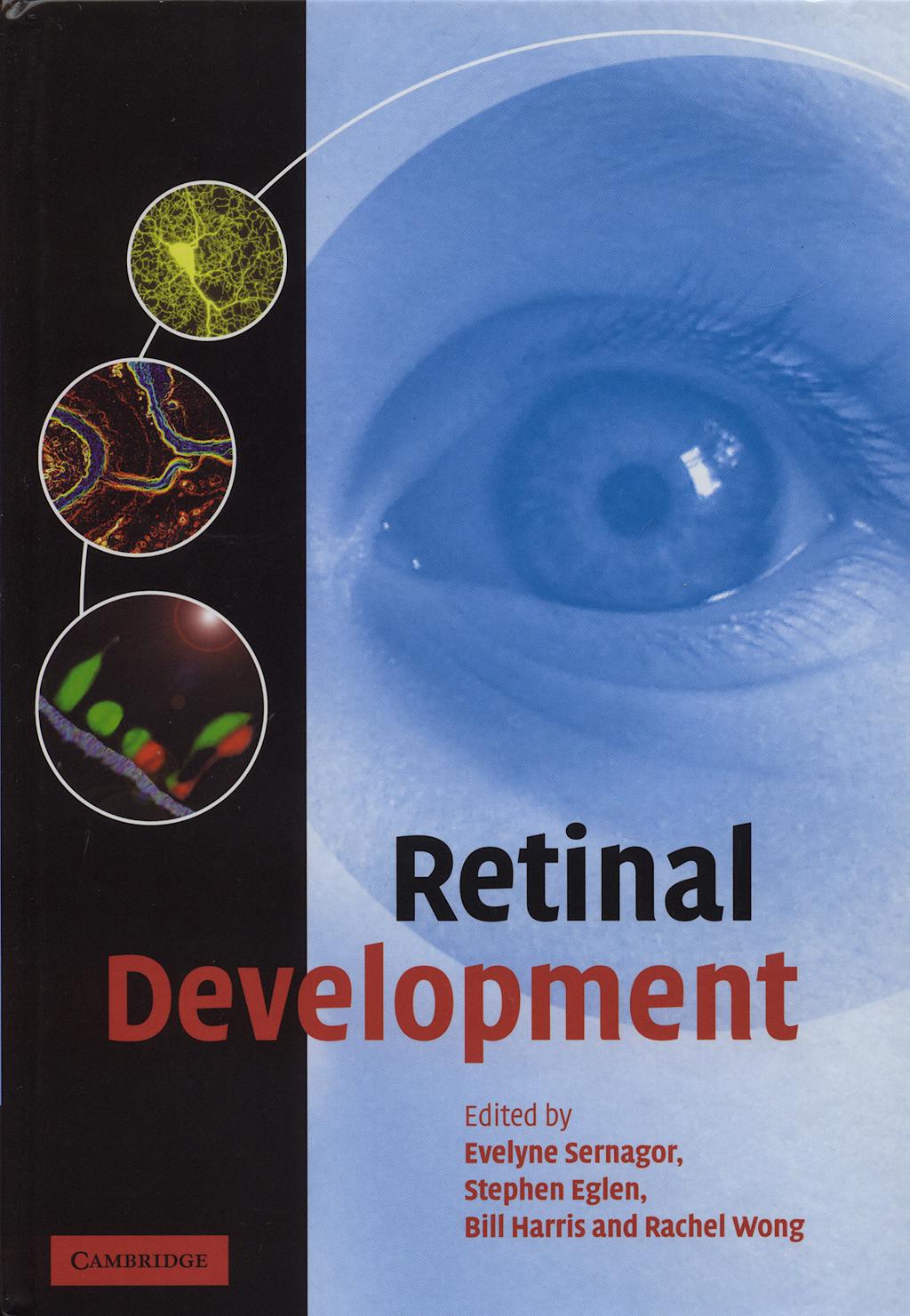 Portada del libro 9780521837989 Retinal Development