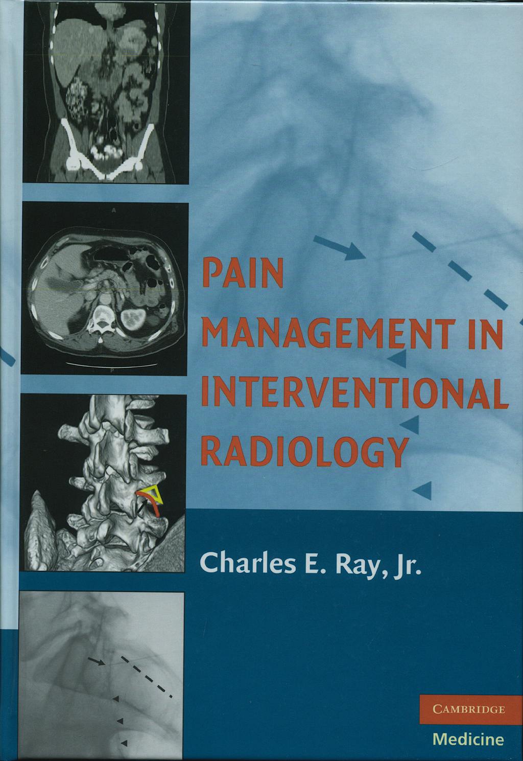 Portada del libro 9780521865920 Pain Management Interventional Radiology