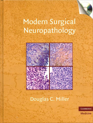 Portada del libro 9780521869324 Modern Surgical Neuropathology
