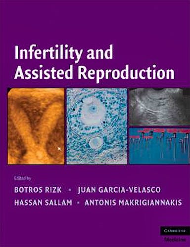 Portada del libro 9780521873796 Infertility And Assisted Reproduction