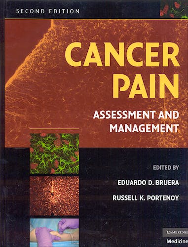 Portada del libro 9780521879279 Cancer Pain. Assessment and Management