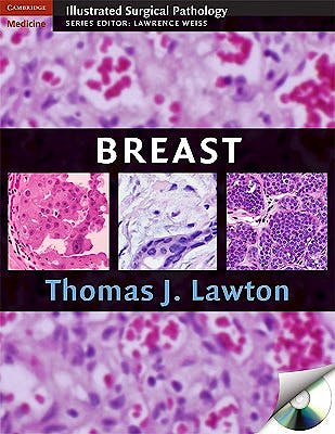 Portada del libro 9780521881593 Breast (Illustrated Surgical Pathology)