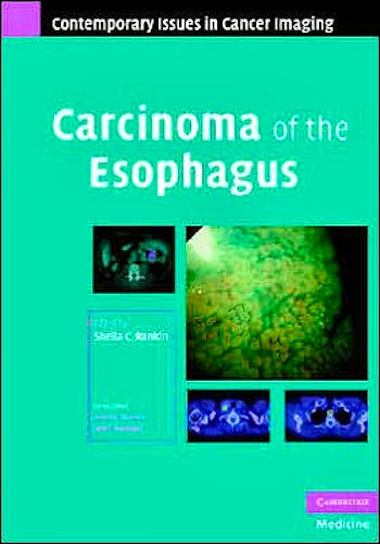 Portada del libro 9780521882859 Carcinoma of the Esophagus