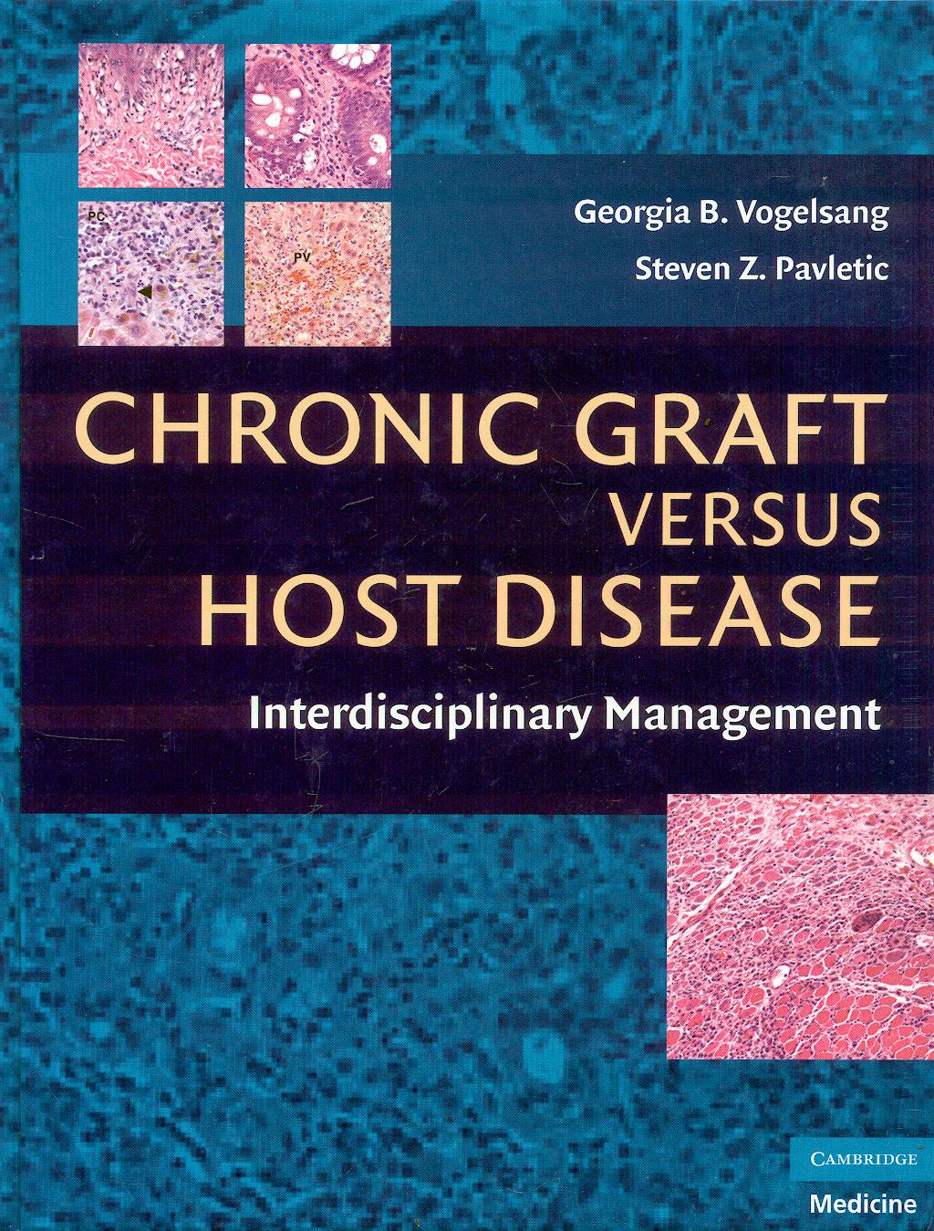 Portada del libro 9780521884235 Chronic Graft versus Host Disease. Interdisciplinary Management