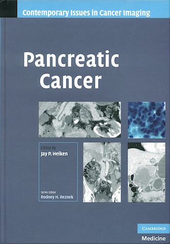 Portada del libro 9780521886925 Pancreatic Cancer (Contemporary Issues in Cancer Imaging)