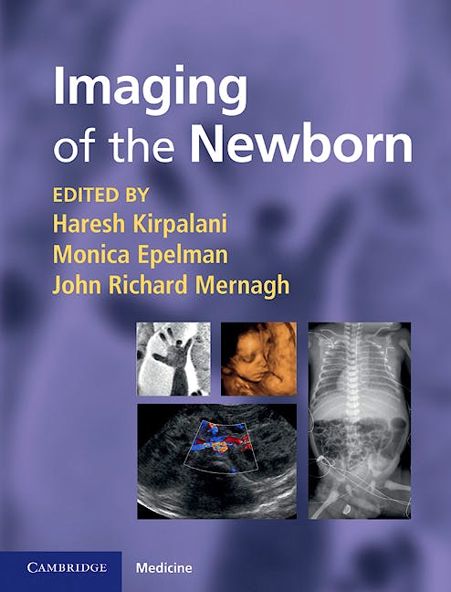 Portada del libro 9780521896269 Imaging the Newborn