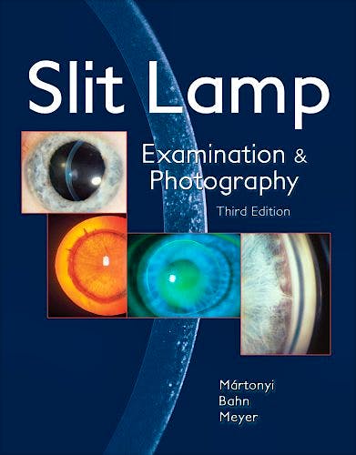 Portada del libro 9780615165196 Slit Lamp. Examination and Photography
