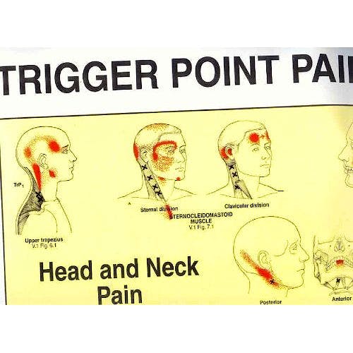 Portada del libro 9780683083682 Travell Trigger Point Pain Charts (2 Laminas)