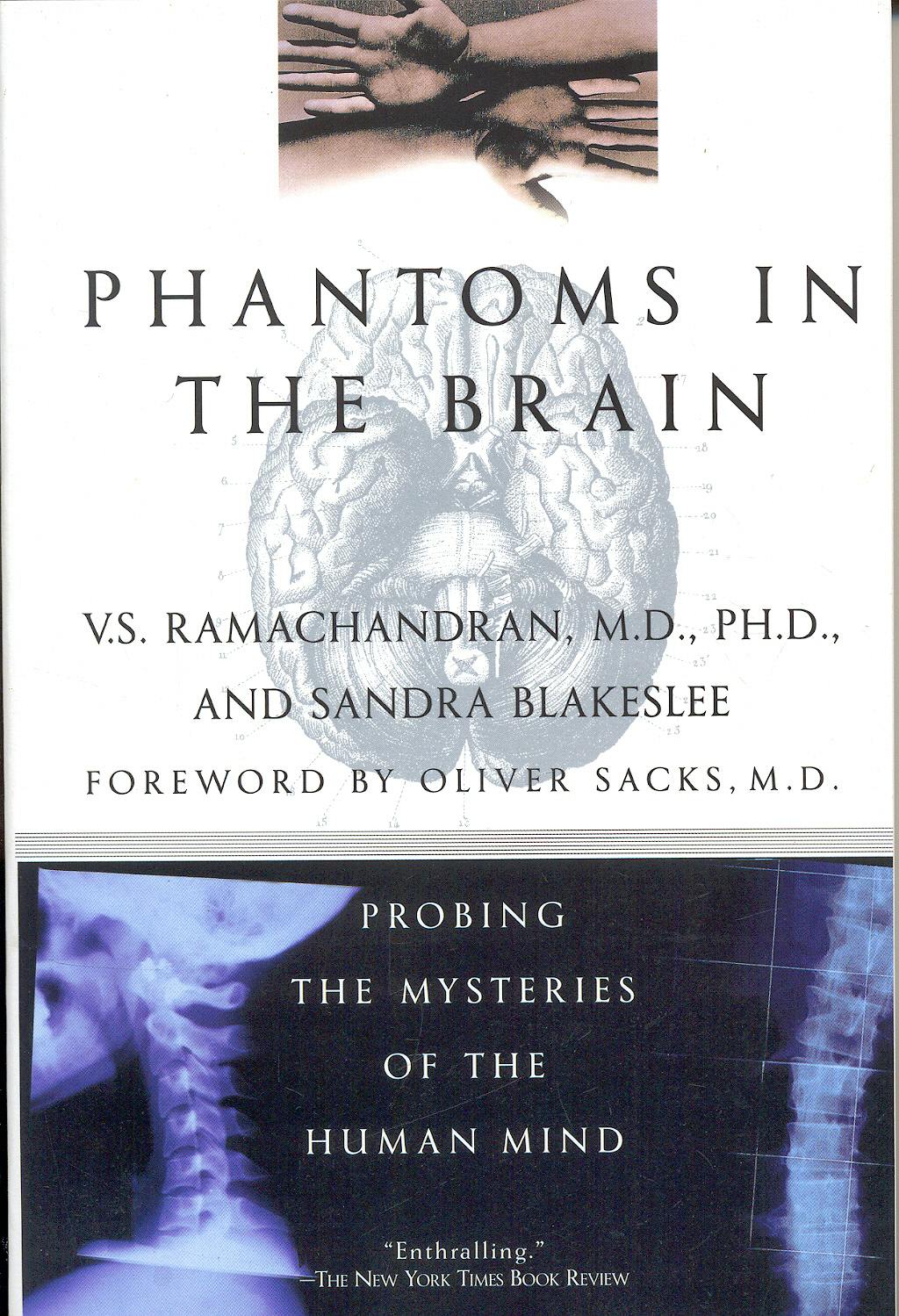 Portada del libro 9780688172176 Phantoms in the Brain