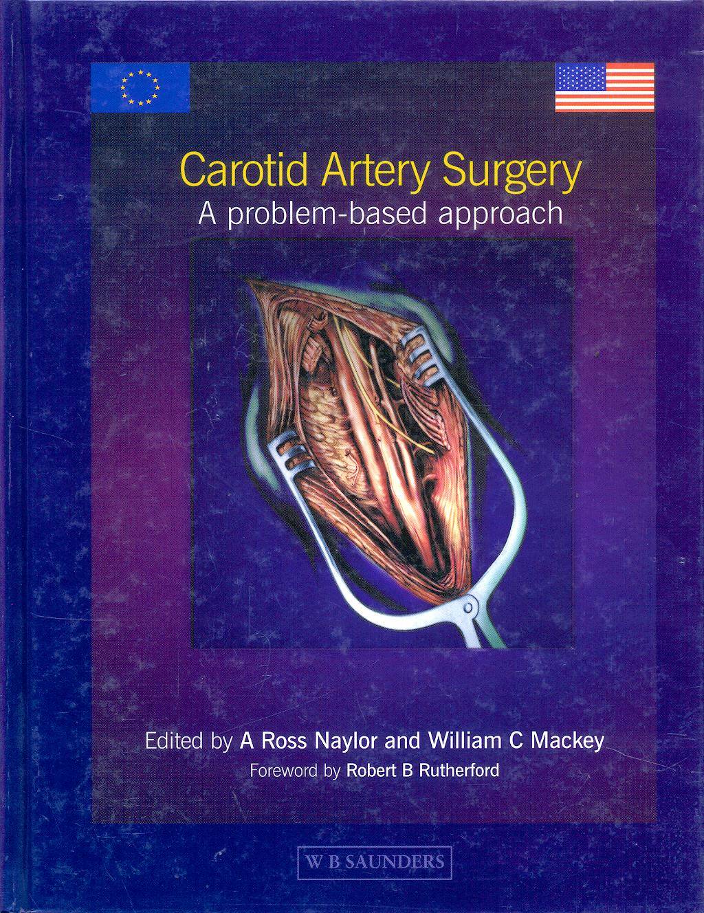 Portada del libro 9780702024320 Carotid Artery Surgery. A Problem-Based Approach