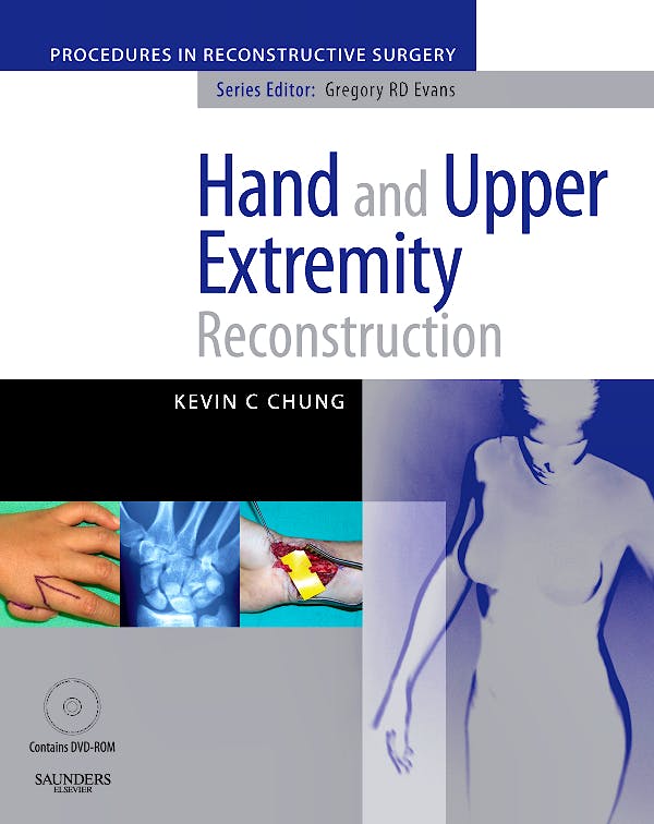 Portada del libro 9780702029165 Hand and Upper Extremity Reconstruction (Procedures in Reconstructive Surgery)