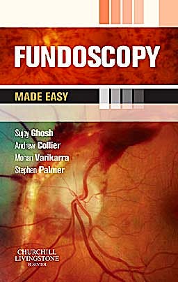 Portada del libro 9780702042973 Fundoscopy. Made Easy