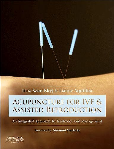 Portada del libro 9780702050107 Acupuncture for IVF and Assisted Reproduction. An Integrated Approach to Treatment and Management