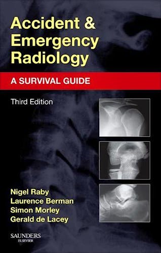 Accident and Emergency Radiology. a Survival Guide