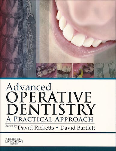 Portada del libro 9780702055386 Advanced Operative Dentistry. A Practical Approach