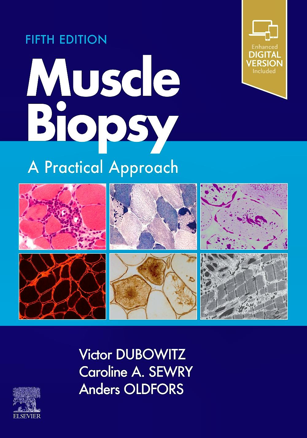Portada del libro 9780702074714 Muscle Biopsy. A Practical Approach (Print + Online)