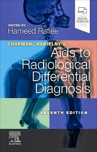 Portada del libro 9780702075391 Chapman and Nakielny's Aids to Radiological Differential Diagnosis
