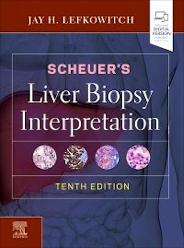 Portada del libro 9780702075841 SCHEUER's Liver Biopsy Interpretation