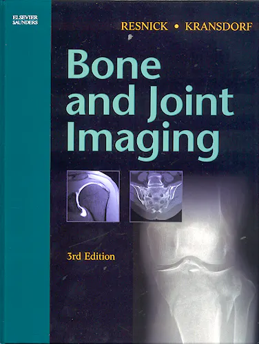 Portada del libro 9780721602707 Bone and Joint Imaging