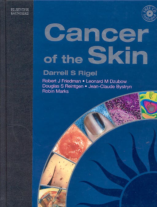 Portada del libro 9780721605449 Cancer of the Skin