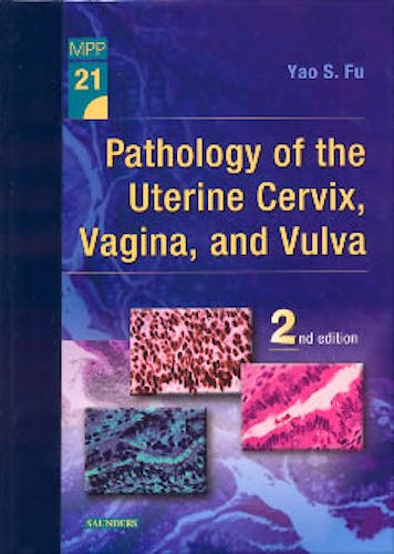 Portada del libro 9780721657561 Pathology of the Uterine Cervix, Vagina, and Vulva