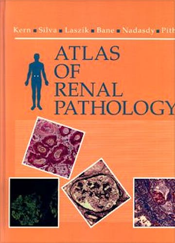 Portada del libro 9780721670676 Atlas of Renal Pathology