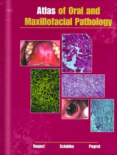 Portada del libro 9780721684604 Atlas of Oral and Maxillofacial Pathology