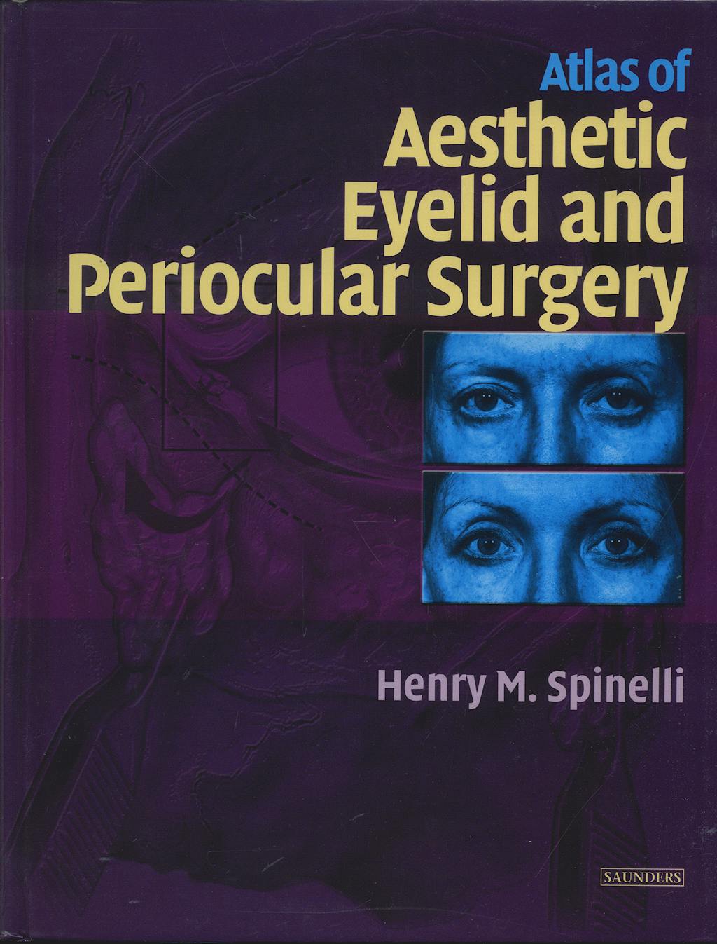 Portada del libro 9780721686332 Atlas of Aesthetic Eyelid and Periocular Surgery