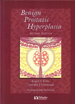 Portada del libro 9780723424482 Benign Prostathic Hyperplasia