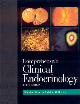 Portada del libro 9780723431855 Comprehensive Clinical Endocrinology