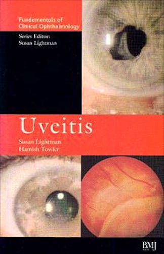 Portada del libro 9780727912022 Uveitis