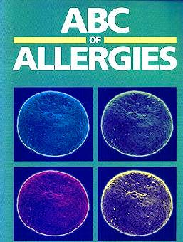 Portada del libro 9780727912367 Abc of Allergies
