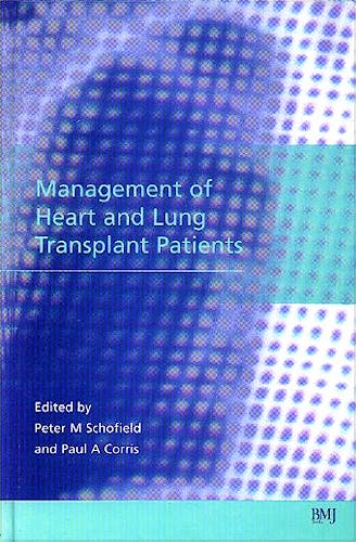Portada del libro 9780727913654 Management of Heart and Lung Transplant Patients